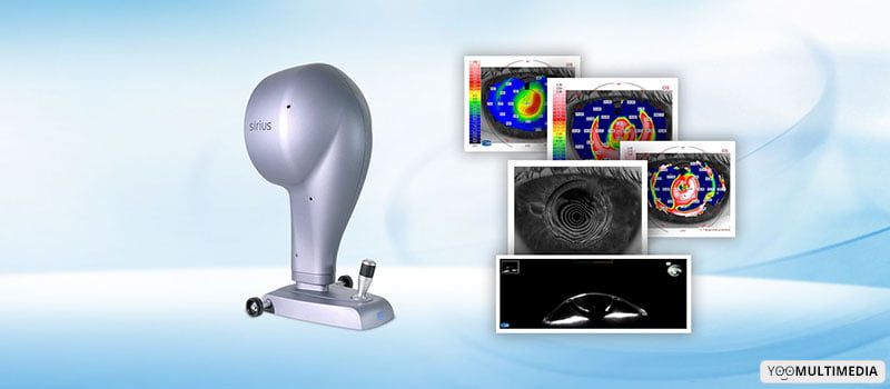 Topografia corneale, mappa corneale bidimensionale e tridimensionale Monza